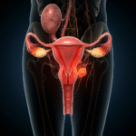 uterus_infection