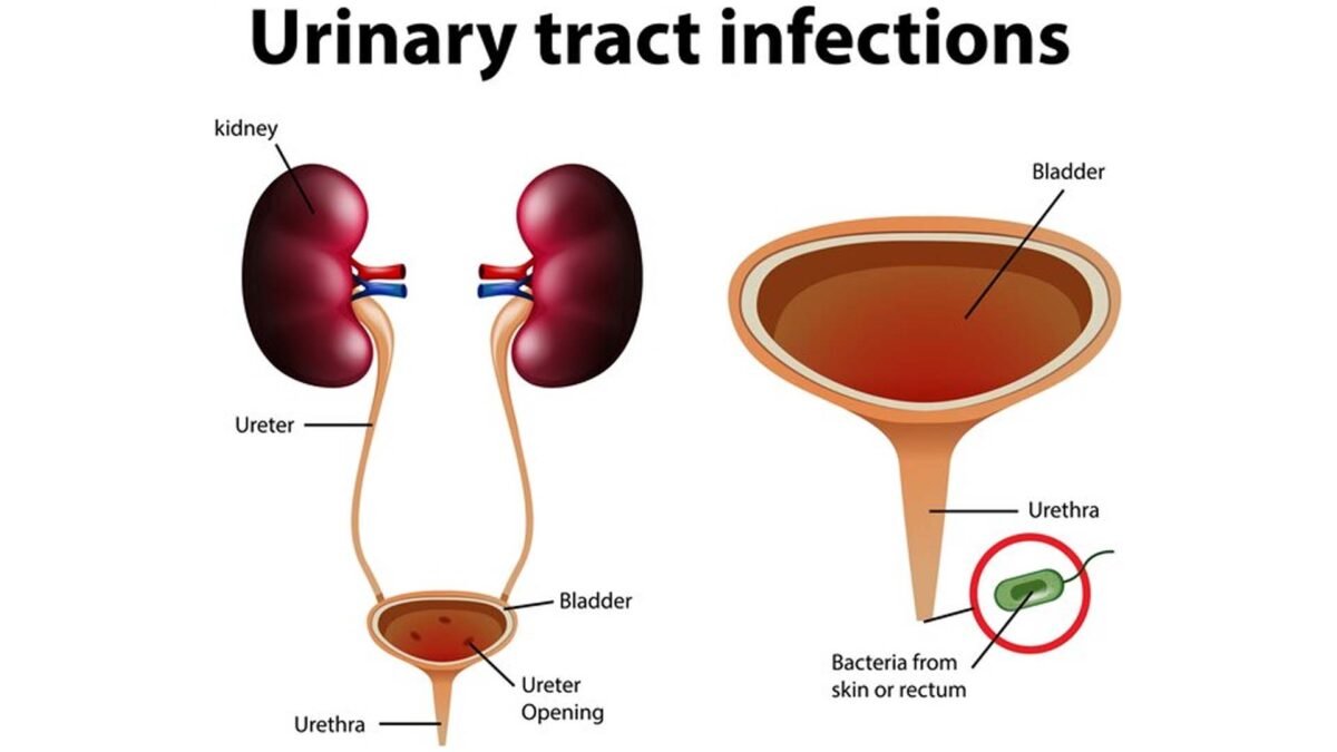 uninary_tract_infection