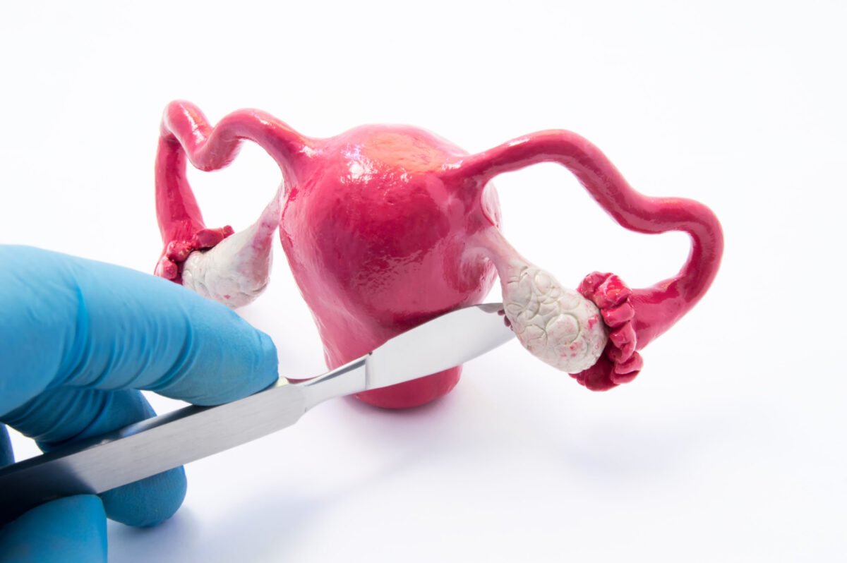 ovarian_cyst_diagnosis​